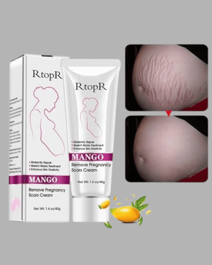 Mango Pregnancy Stretch Marks Removal Cream – Skin Repair Care